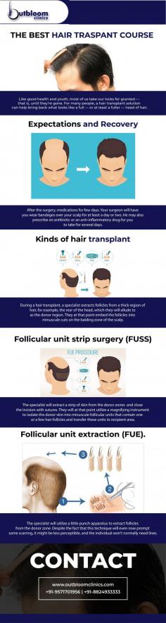 The hairless area, which is generally seen as a result of spillage in men, is an effective treatment method for obtaining natural hair appearance. Often about 90% of the resulting hair loss is caused by genetics, drugs, creams or cosmetics that are used to reach old hair do not give satisfactory results. Outbloom specialist hair transplant course is customized for both beginner and advanced level participants. Doctor trainees are tutored in the latest, cutting-edge hair transplant techniques, including FUE, by Dr Aklish Jain himself in Outbloom Skin & Hair Clinic. For more info visit here: https://www.outbloomclinics.com/