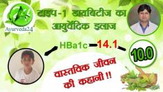 Do You Know Type 1 Diabetes Cure from Ayurveda,  Do you want to know Why Ayurveda is an effective treatment for diabetes?  Listen to The Success story of the diabetes Patient's Mother, With the complete report. this patient have taken insulin for 6 days earlier but after that, they left it on their own. 

A boy is 'cured' of type 1 diabetes through Ayurveda Medicine. The first case of Type 1 diabetes (T1D) reversal Using Ayurveda medicine.

#treating_type_1_diabetes
#cure_for_type_1_diabetes.
#juvenile_diabetes
#natural_treatment_juvenile_diabetes
#Type1_Diabetes_Treatment_In_Ayurveda
#Diabetes_Treatment_in_Ayurveda
#The_success_story_of_diabetes
#Diabetes_Patients_Success_Story
#Type_1_Diabetes_Success_Story
#Is_there_a_cure_for_type_1_diabetes?