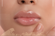 Enhance your natural beauty with Lip Filler in Center Moriches. This popular cosmetic treatment adds volume, shape, and definition to your lips, creating a fuller and more youthful look. Lip Filler in Center Moriches is performed by experienced professionals who use safe, high-quality fillers to achieve subtle and natural results. Whether you desire more volume or wish to balance your lip proportions, this treatment is customizable to your preferences. Enjoy immediate results with minimal downtime, and step out with confidence. Schedule your lip filler appointment today and transform your smile into your most striking feature.